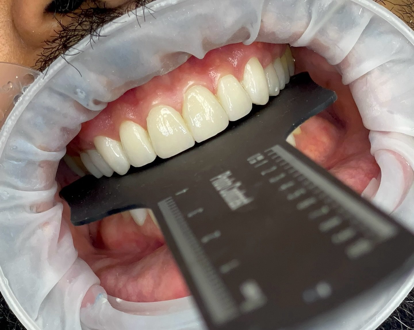 Tratamiento integral